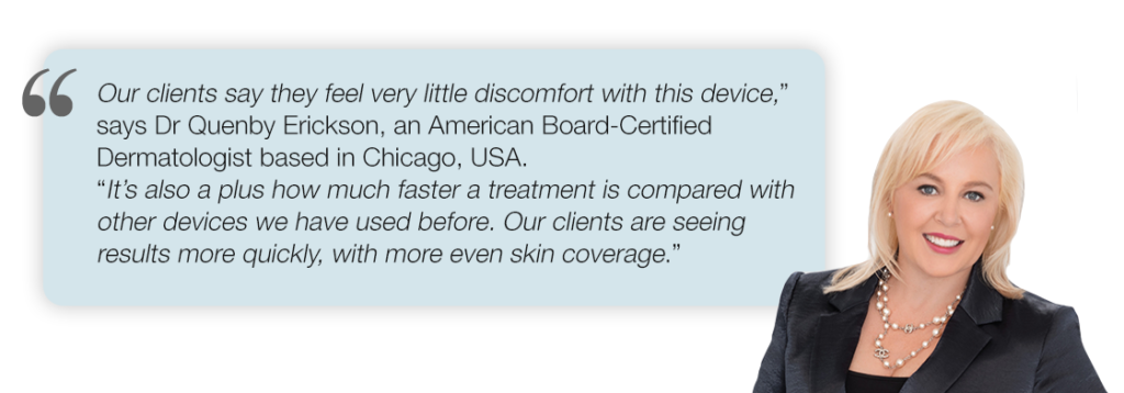 Splendor X is Revolutionizing Laser Hair Removal | Lumenis