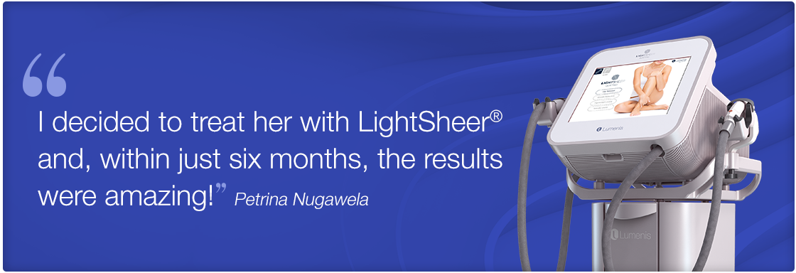 I decided to treat her with LightSheer and, withing just six months, the results were amazing