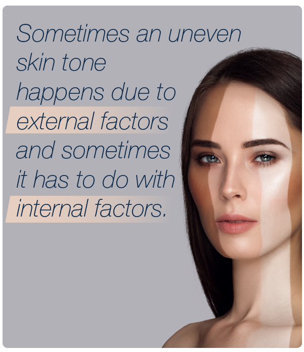 Sometimes an uneven skin tone happens due to external factors and sometimes it has to do with internal factors